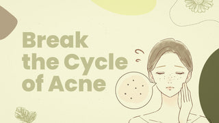 WHY DOES YOUR ACNE KEEP COMING BACK?