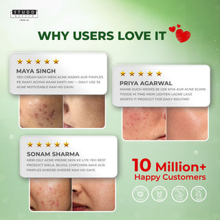 Anti-Acne Face Cream