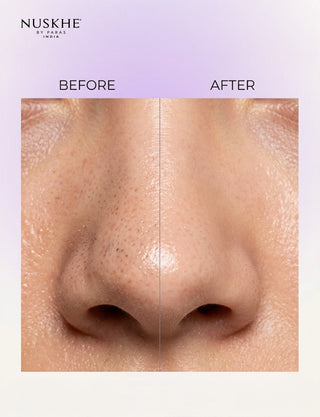 Nose Peel Off Mask