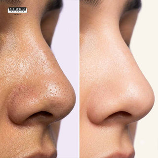 Nose Scrub