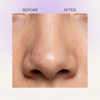 Nose Peel Off Mask