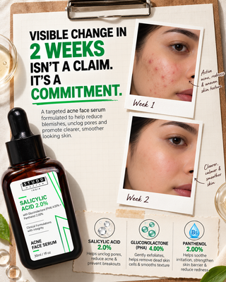 Salicylic Acid 2% Acne Face Serum (30ml)