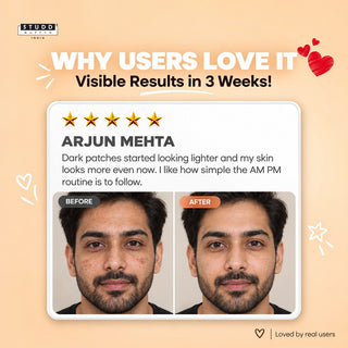 AM PM Pigmentation Duo ( 50gm )