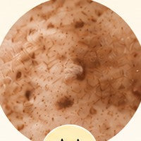 PIGMENTATION