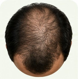 Stage 4
