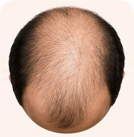 Stage 6